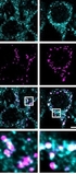 Optogenetic manipulation of lysosomes