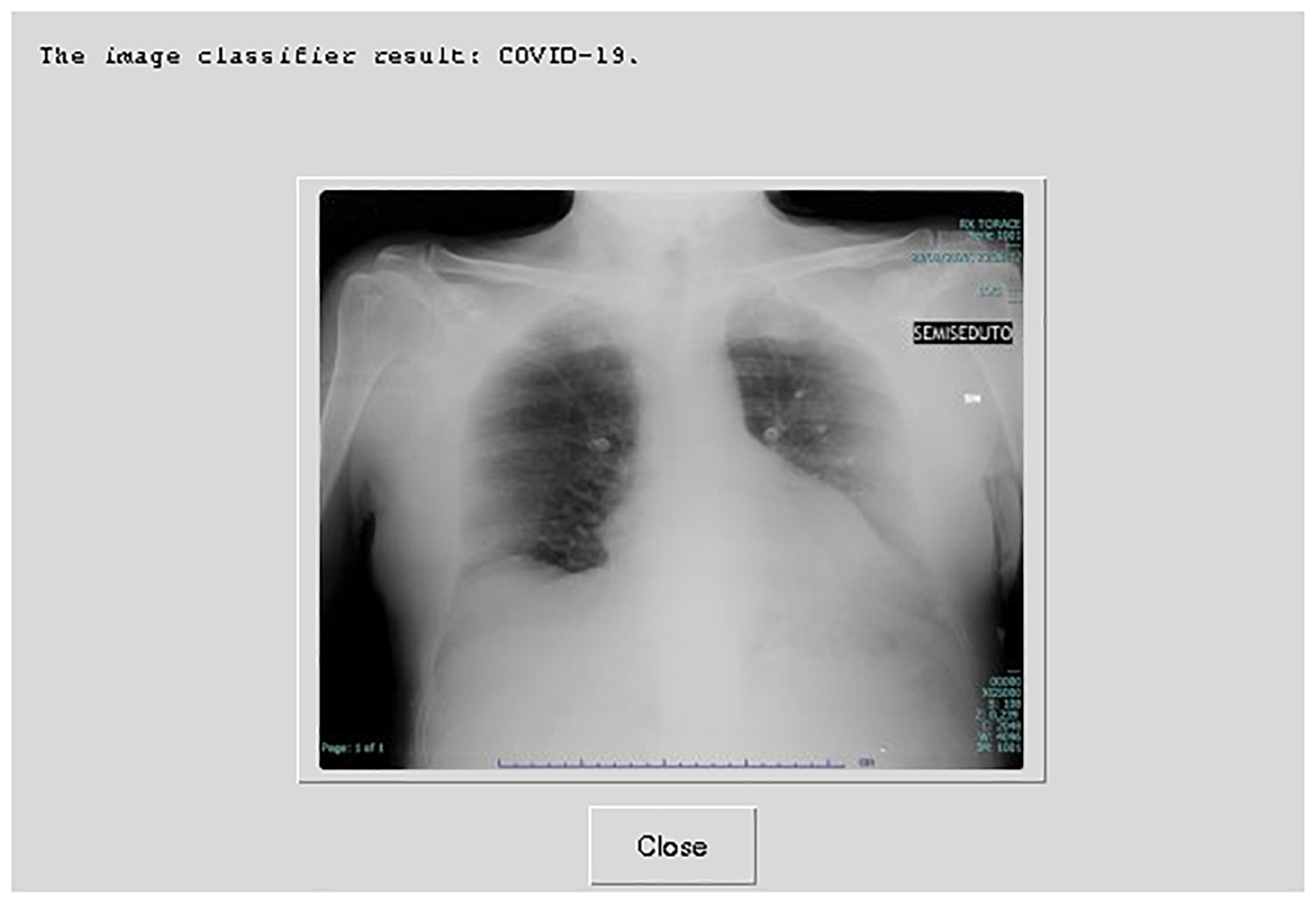 COVID-19 diagnosis from CT scans and X-ray images using low-cost Pi | PLOS ONE