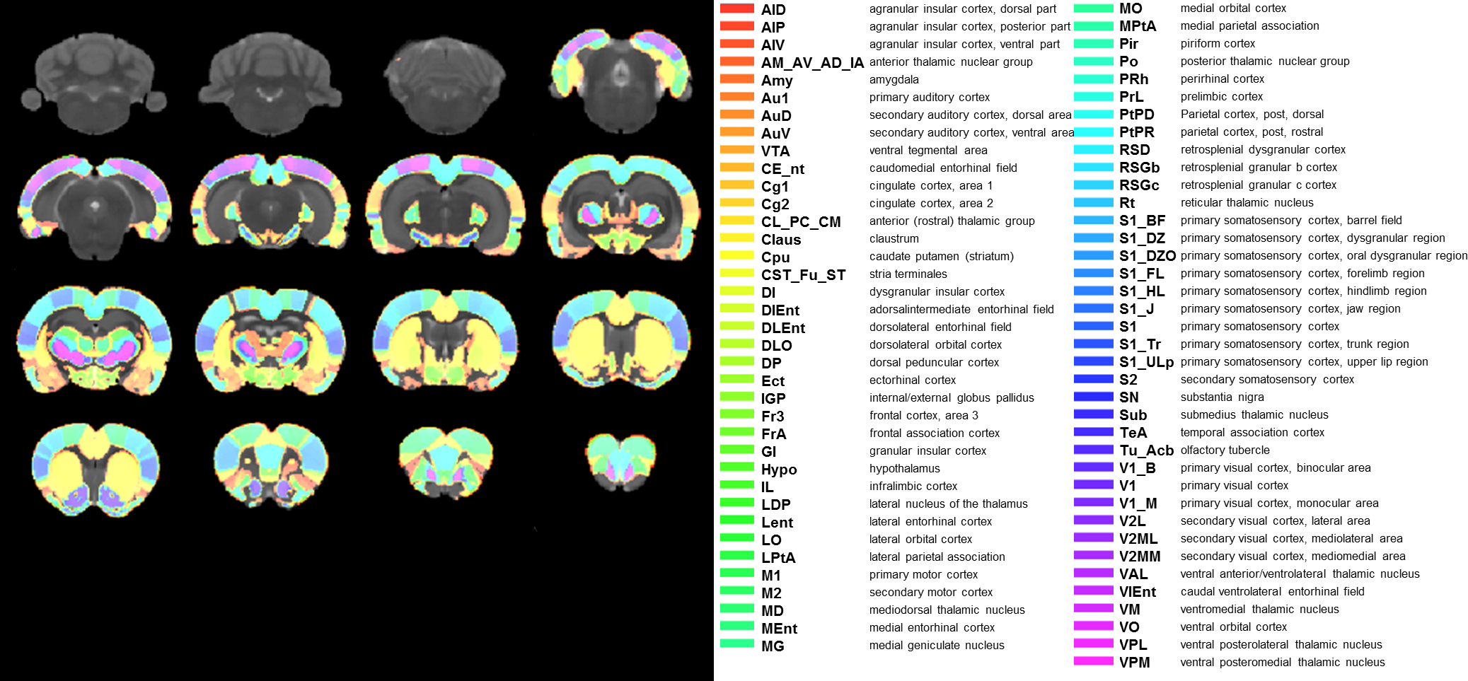Characterization of the resting-state brain network topology in ...