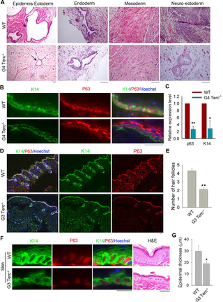 <h2>Short telomeres impair epidermal differentiation <i>in vivo</i>.</h2>