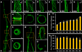Visualization of actin organization in type II trichomes using Lifeact-eGFP fusion protein.