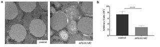 Afg3l2 deficiency results in mitochondrial morphological defects.
