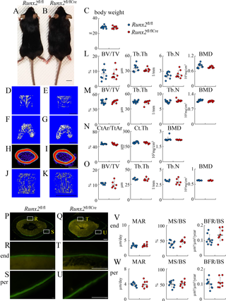 Micro-CT and bone histomorphometric analyses of <i>Runx2</i><sup>fl/fl</sup> and <i>Runx2</i><sup>fl/flCre</sup> male mice at 20 weeks of age.
