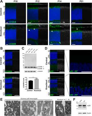 Loss of <i>Rabgef1</i> leads to autophagy defects in the retinal photoreceptors.