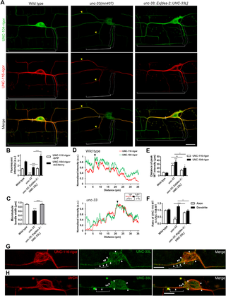 UNC-33 regulates microtubule organization in the cell body and is required for axonal KIF5/UNC-116-associated microtubule tracks.