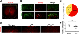 The number of RORB-positive neurons are drastically reduced in the spinal cord of <i>sauteur</i> rabbits.