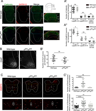 In <i>sauteur</i> rabbits the differentiation of dorsal horn interneurons and DMRT3-expressing neurons is disturbed but motor neurons are not affected.