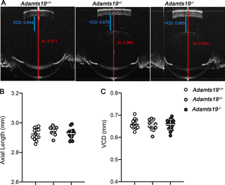 ADAMTS19 is not required for ocular axial growth during normal development.