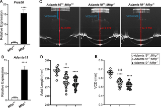 <i>Adamts19</i> inactivation exacerbates the reduction in ocular axial length in <i>Mfrp</i> mutant mice.