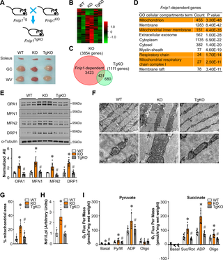 FNIP1-dependent regulation of mitochondrial remodeling in skeletal muscle.