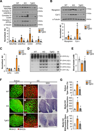 FNIP1-dependent muscle oxidative fiber type transformation.