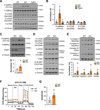 FNIP1 inhibits muscle AMPK pathway and mitochondrial oxidative program in a cell-autonomous manner.