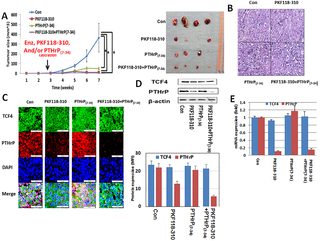 <h2>Effect of TCF4/β-catenin inhibitor (PKF118-310) and PTHrP antagonist (PTHrP<sub>(7–34)</sub>) in enzalutamide-resistant prostate cancer.</h2>