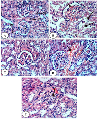 <h2>Photomicrographs of H & E stained kidney sections.</h2>