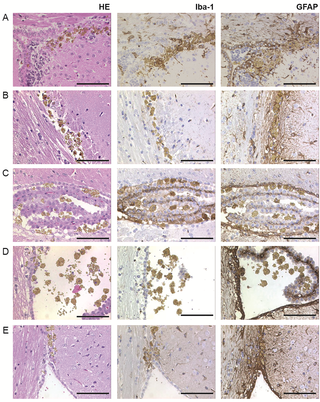 <h2>Histopathological analysis of tissue reactions to intracerebral bead inoculation.</h2>