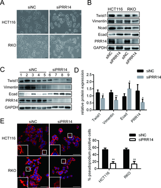 Modulation of EMT and the formation of pseudopodia in the colon cancer cells following PRR14 depletion.