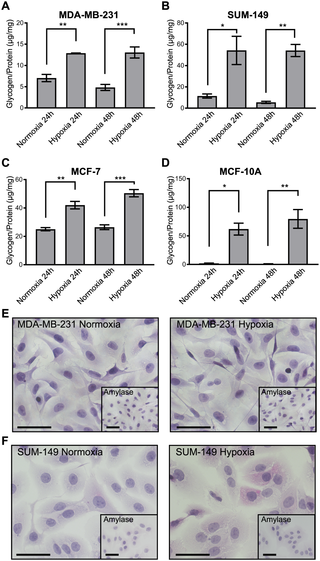 <h2>Glycogen accumulates in breast cancer cells under hypoxic conditions across subtypes.</h2>