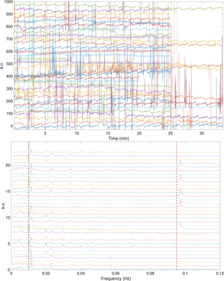 <h2>The pulse transit time (PTT) during the entire laparoscopic cholecystectomy procedure of all enrolled subjects in the SKWHSMH database is shown in the top subplot, and their associated power spectra are shown in the bottom subplot.</h2>