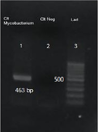 <h2>PCR results of the first amplification of partial sequence of mycobacterial hsp 65 with M1 & M4 primers.</h2>