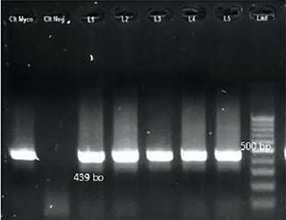 <h2>Nested-PCR results of <i>Mycobacterium</i> spp. with TB11 & TB12 primers.</h2>