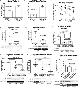 <h2>Obesity and diabetes led to white adipose tissue neuropathy.</h2>