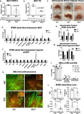 <h2>Neuropathy extends beyond white adipose tissue in BTBR <i>ob/ob</i> mice.</h2>