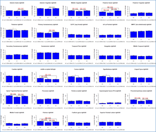 Bar graphs showing the connectivity strength for 29 homotopic regions for healthy controls (HC), concussed patients 1-month post-concussion (time-point CI) and at 5-month post-concussion (time-point CII).