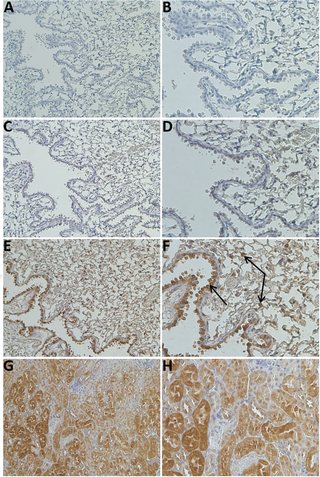 <h2>GSTCD protein expression indicates bronchial epithelial localisation as assessed by IHC in <i>GSTCD<sup>+/+</sup></i> C57BL/6N mouse lung tissue.</h2>