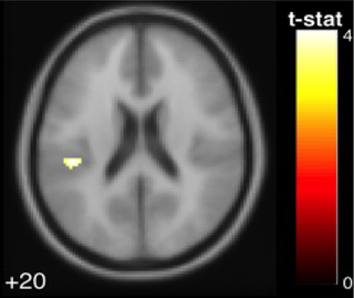<h2>The parietal operculum cortex exhibited a negative association with age in the pooled young and older adults group.</h2>