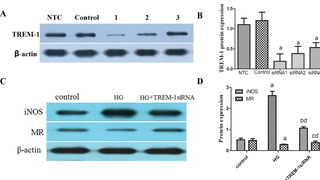 <h2>Effects of TREM-1 siRNA on M1/M2 macrophage-specific markers expression.</h2>
