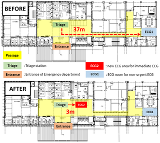 <h2>Layout of the emergency department with marks of the locations for ECG examination before and after quality-improving initiatives.</h2>