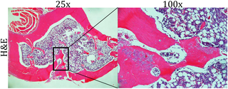<h2>Histology of metaphyseal defect.</h2>