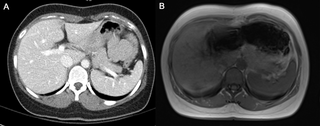 <h2>Quality of CT and MR images for TAMA measurement.</h2>