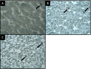 <h2>Sagittal histological section of larvae liver plaice.</h2>