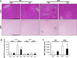 <h2>CCR2 depletion decreases lipid accumulation in the liver and WAT.</h2>