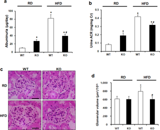 <h2>CCR2 depletion ameliorates HFD-induced albuminuria and glomerular hypertrophy.</h2>