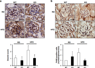 <h2>The effect of CCR2 depletion on podocyte injury and macrophage infiltration.</h2>