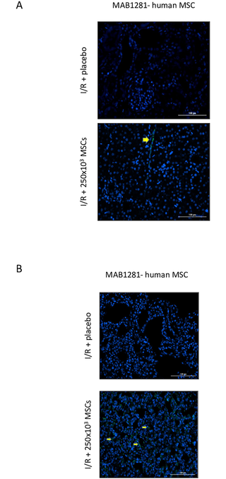 <h2>Human MSCs in rat tissue.</h2>