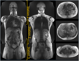<h2>In-vivo images of a large volunteer using TIAMO.</h2>