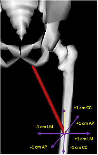 Modification of the location of the insertion point of the adductor magnus middle from the baseline model.