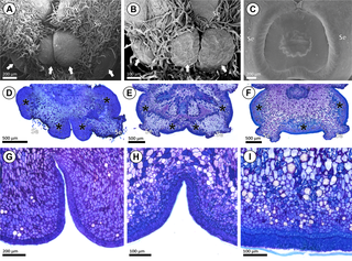 <h2>Morphoanatomy of sepal glands in <i>Acridocarpus</i> species.</h2>