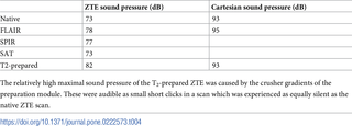 <h2>Comparison of the highest registered acoustic sound pressure of the Cartesian and ZTE scans.</h2>