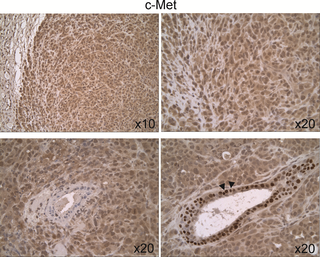 <h2>Expression and cellular distribution of c-Met in untreated 231/LM2-4 tumor xenografts.</h2>