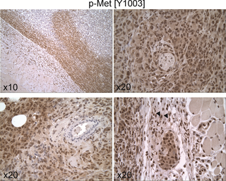 <h2>Expression and cellular distribution of p-Met[Y1003] in untreated 231/LM2-4 tumor xenografts.</h2>