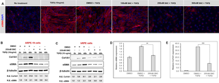 <h2>Salinomycin (SNC) treatment inhibits RPE TGFβ-induced EMT to fibroblasts.</h2>