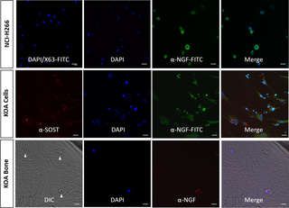 NGF expression in isolated human osteocytes and in KOA bone.