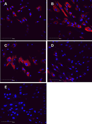 NGF expression in isolated human osteocytes.