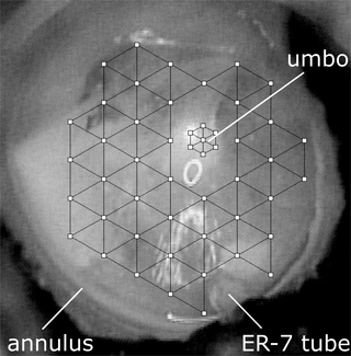 <h2>The LDV measurement grid used for a central perforation leaving an annular rim condition repaired by covering with perichondrium.</h2>