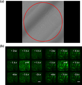 <h2>Calculated phase pattern and the raw images with uniform and speckle illumination (a) Phase pattern for the MFM calculated based on the weighted global GS algorithm, where the red circle represents the back aperture area relayed from the objective; (b) raw images of mouse kidney slices under uniform illumination (left) and speckle illumination (right).</h2>