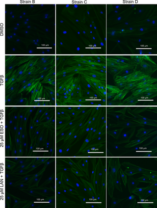 <h2>PPIs prevent the TGFβ-induced myofibroblast marker αSMA expression.</h2>